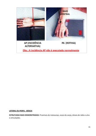 41
LATERAL OU PERFIL - BÁSICA
ESTRUTURAS MAIS DEMONSTRADAS: Proximais do metacarpo, ossos do carpo, distais de rádio e ulna
e articulações.
 