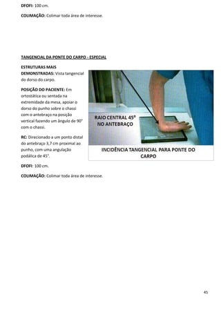 45
DFOFI: 100 cm.
COLIMAÇÃO: Colimar toda área de interesse.
TANGENCIAL DA PONTE DO CARPO - ESPECIAL
ESTRUTURAS MAIS
DEMONSTRADAS: Vista tangencial
do dorso do carpo.
POSIÇÃO DO PACIENTE: Em
ortostática ou sentada na
extremidade da mesa, apoiar o
dorso do punho sobre o chassi
com o antebraço na posição
vertical fazendo um ângulo de 90°
com o chassi.
RC: Direcionado a um ponto distal
do antebraço 3,7 cm proximal ao
punho, com uma angulação
podálica de 45°.
DFOFI: 100 cm.
COLIMAÇÃO: Colimar toda área de interesse.
 