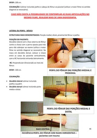 86
DFOFI: 100 cm.
COLIMAÇÃO: Colimar incluindo joelho e cabeça do fêmur se possível (utilizar o maior filme no sentido
diagonal se necessário).
CASO NÃO EXISTA A POSSIBILIDADE DE CONTEMPLAR AS DUAS ARTICULAÇÕES NO
MESMO FILME, REALIZAR MAIS DE UMA RADIOGRAFIA.
LATERAL OU PERFIL - BÁSICA
ESTRUTURAS MAIS DEMONSTRADAS: Porção medial, distal, proximal do fêmur e joelho.
POSIÇÃO DO PACIENTE:
Decúbito lateral com a face externa do fêmur
contra o chassi com a perna oposta para trás
para não sobrepor ao exame (utiliza o maior
filme no sentido diagonal se necessário). Na
maca em decúbito dorsal, colocar o chassi
entre as coxas do paciente verticalmente,
com o RC horizontal entrando lateralmente.
RC: Perpendicular direcionado ao meio do
fêmur.
DFOFI: 100 cm.
COLIMAÇÃO:
 Decúbito lateral colimar incluindo
joelho e quadril.
 Decúbito dorsal colimar incluindo parte
média e distal.
 