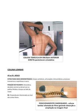 104
COLUNA LOMBAR
AP ou PA - BÁSICA
ESTRUTURAS MAIS DEMONSTRADAS: Corpos vertebrais, articulações intervertebrais, processos
transversos e espinhosos e sacro.
POSIÇÃO DO PACIENTE: Ortostática,
decúbito ventral ou dorsal com os
joelhos fletidos e braços ao lado do
corpo.
RC: Perpendicular direcionado ao nível
das cristas ilíacas.
 