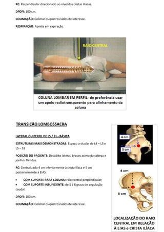 107
RC: Perpendicular direcionado ao nível das cristas ilíacas.
DFOFI: 100 cm.
COLIMAÇÃO: Colimar os quatros lados de interesse.
RESPIRAÇÃO: Apnéia em expiração.
TRANSIÇÃO LOMBOSSACRA
LATERAL OU PERFIL DE L5 / S1 - BÁSICA
ESTRUTURAS MAIS DEMONSTRADAS: Espaço articular de L4 – L5 e
L5 – S1
POSIÇÃO DO PACIENTE: Decúbito lateral, braços acima da cabeça e
joelhos fletidos.
RC: Centralizado 4 cm inferiormente à crista ilíaca e 5 cm
posteriormente à EIAS.
 COM SUPORTE PARA COLUNA: raio central perpendicular;
 COM SUPORTE INSUFICIENTE: de 5 à 8 graus de angulação
caudal.
DFOFI: 100 cm.
COLIMAÇÃO: Colimar os quatros lados de interesse.
 