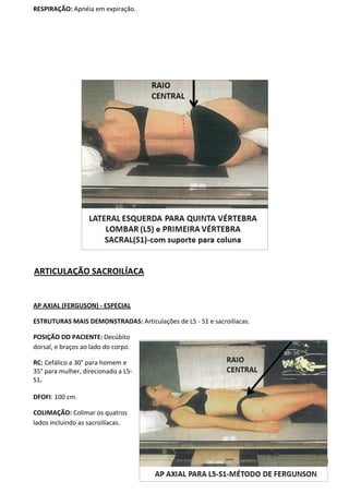 108
RESPIRAÇÃO: Apnéia em expiração.
ARTICULAÇÃO SACROILÍACA
AP AXIAL (FERGUSON) - ESPECIAL
ESTRUTURAS MAIS DEMONSTRADAS: Articulações de L5 - S1 e sacroilíacas.
POSIÇÃO DO PACIENTE: Decúbito
dorsal, e braços ao lado do corpo.
RC: Cefálico a 30° para homem e
35° para mulher, direcionado a L5-
S1.
DFOFI: 100 cm.
COLIMAÇÃO: Colimar os quatros
lados incluindo as sacroilíacas.
 
