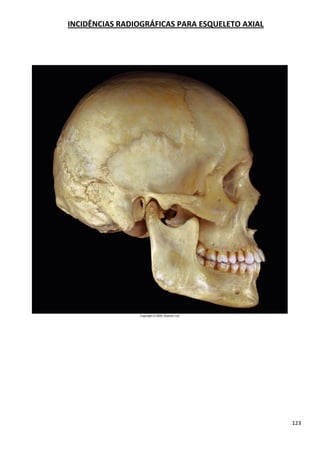 123
INCIDÊNCIAS RADIOGRÁFICAS PARA ESQUELETO AXIAL
 