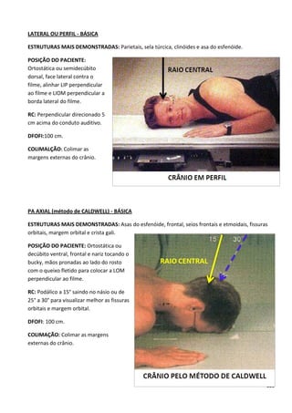 125
LATERAL OU PERFIL - BÁSICA
ESTRUTURAS MAIS DEMONSTRADAS: Parietais, sela túrcica, clinóides e asa do esfenóide.
POSIÇÃO DO PACIENTE:
Ortostática ou semidecúbito
dorsal, face lateral contra o
filme, alinhar LIP perpendicular
ao filme e LIOM perpendicular a
borda lateral do filme.
RC: Perpendicular direcionado 5
cm acima do conduto auditivo.
DFOFI:100 cm.
COLIMALÇÃO: Colimar as
margens externas do crânio.
PA AXIAL (método de CALDWELL) - BÁSICA
ESTRUTURAS MAIS DEMONSTRADAS: Asas do esfenóide, frontal, seios frontais e etmoidais, fissuras
orbitais, margem orbital e crista gali.
POSIÇÃO DO PACIENTE: Ortostática ou
decúbito ventral, frontal e nariz tocando o
bucky, mãos pronadas ao lado do rosto
com o queixo fletido para colocar a LOM
perpendicular ao filme.
RC: Podálico a 15° saindo no násio ou de
25° a 30° para visualizar melhor as fissuras
orbitais e margem orbital.
DFOFI: 100 cm.
COLIMAÇÃO: Colimar as margens
externas do crânio.
 