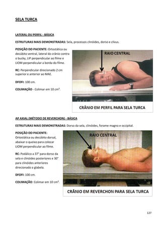 127
SELA TURCA
LATERAL OU PERFIL - BÁSICA
ESTRUTURAS MAIS DEMONSTRADAS: Sela, processos clinóides, dorso e clívus.
POSIÇÃO DO PACIENTE: Ortostática ou
decúbito ventral, lateral do crânio contra
o bucky, LIP perpendicular ao filme e
LIOM perpendicular a borda do filme.
RC: Perpendicular direcionado 2 cm
superior e anterior ao MAE.
DFOFI: 100 cm.
COLIMAÇÃO - Colimar em 10 cm².
AP AXIAL (MÉTODO DE REVERCHON) - BÁSICA
ESTRUTURAS MAIS DEMONSTRADAS: Dorso da sela, clinóides, forame magno e occipital.
POSIÇÃO DO PACIENTE:
Ortostática ou decúbito dorsal,
abaixar o queixo para colocar
LIOM perpendicular ao filme.
RC: Podálico a 37° para dorso da
sela e clinóides posteriores e 30°
para clinóides anteriores
direcionado a glabela.
DFOFI: 100 cm.
COLIMAÇÃO: Colimar em 10 cm².
 