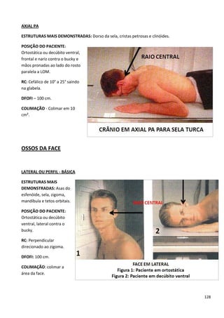 128
AXIAL PA
ESTRUTURAS MAIS DEMONSTRADAS: Dorso da sela, cristas petrosas e clinóides.
POSIÇÃO DO PACIENTE:
Ortostática ou decúbito ventral,
frontal e nariz contra o bucky e
mãos pronadas ao lado do rosto
paralela a LOM.
RC: Cefálico de 10° a 25° saindo
na glabela.
DFOFI – 100 cm.
COLIMAÇÃO - Colimar em 10
cm².
OSSOS DA FACE
LATERAL OU PERFIL - BÁSICA
ESTRUTURAS MAIS
DEMONSTRADAS: Asas do
esfenóide, sela, zigoma,
mandíbula e tetos orbitais.
POSIÇÃO DO PACIENTE:
Ortostática ou decúbito
ventral, lateral contra o
bucky.
RC: Perpendicular
direcionado ao zigoma.
DFOFI: 100 cm.
COLIMAÇÃO: colimar a
área da face.
 
