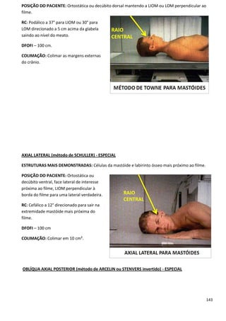 143
POSIÇÃO DO PACIENTE: Ortostática ou decúbito dorsal mantendo a LIOM ou LOM perpendicular ao
filme.
RC: Podálico a 37° para LIOM ou 30° para
LOM direcionado a 5 cm acima da glabela
saindo ao nível do meato.
DFOFI – 100 cm.
COLIMAÇÃO: Colimar as margens externas
do crânio.
AXIAL LATERAL (método de SCHULLER) - ESPECIAL
ESTRUTURAS MAIS DEMONSTRADAS: Células da mastóide e labirinto ósseo mais próximo ao filme.
POSIÇÃO DO PACIENTE: Ortostática ou
decúbito ventral, face lateral de interesse
próxima ao filme, LIOM perpendicular à
borda do filme para uma lateral verdadeira.
RC: Cefálico a 12° direcionado para sair na
extremidade mastóide mais próxima do
filme.
DFOFI – 100 cm
COLIMAÇÃO: Colimar em 10 cm².
OBLÍQUA AXIAL POSTERIOR (método de ARCELIN ou STENVERS invertido) - ESPECIAL
 