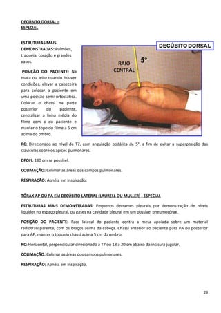 23
DECÚBITO DORSAL –
ESPECIAL
ESTRUTURAS MAIS
DEMONSTRADAS: Pulmões,
traquéia, coração e grandes
vasos.
POSIÇÃO DO PACIENTE: Na
maca ou leito quando houver
condições, elevar a cabeceira
para colocar o paciente em
uma posição semi-ortostática.
Colocar o chassi na parte
posterior do paciente,
centralizar a linha média do
filme com a do paciente e
manter o topo do filme a 5 cm
acima do ombro.
RC: Direcionado ao nível de T7, com angulação podálica de 5°, a fim de evitar a superposição das
clavículas sobre os ápices pulmonares.
DFOFI: 180 cm se possível.
COLIMAÇÃO: Colimar as áreas dos campos pulmonares.
RESPIRAÇÃO: Apnéia em inspiração.
TÓRAX AP OU PA EM DECÚBITO LATERAL (LAURELL OU MULLER) - ESPECIAL
ESTRUTURAS MAIS DEMONSTRADAS: Pequenos derrames pleurais por demonstração de níveis
líquidos no espaço pleural, ou gases na cavidade pleural em um possível pneumotórax.
POSIÇÃO DO PACIENTE: Face lateral do paciente contra a mesa apoiada sobre um material
radiotransparente, com os braços acima da cabeça. Chassi anterior ao paciente para PA ou posterior
para AP, manter o topo do chassi acima 5 cm do ombro.
RC: Horizontal, perpendicular direcionado a T7 ou 18 a 20 cm abaixo da incisura jugular.
COLIMAÇÃO: Colimar as áreas dos campos pulmonares.
RESPIRAÇÃO: Apnéia em inspiração.
 