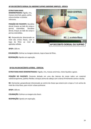 29
AP EM DECÚBITO DORSAL OU ABDOME SUPINO (ABDOME SIMPLES) - BÁSICA
ESTRUTURAS MAIS
DEMONSTRADAS: Fígado, rins,
massas anormais, gases, pelve,
coluna lombar e costelas
inferiores.
POSIÇÃO DO PACIENTE: Decúbito
dorsal, braços ao lado do corpo e
pernas estendidas. Decúbito
dorsal, braços ao lado do corpo e
pernas estendidas.
RC: Perpendicular direcionado ao
nível das cristas ilíacas, com o
topo do filme ao nível do
apêndice xifóide.
DFOFI: 100 cm.
COLIMAÇÃO: Colimar as margens laterais, topo e base do filme.
RESPIRAÇÃO: Apnéia em expiração.
AP OU PA EM DECÚBITO LATERAL - ESPECIAL
ESTRUTURAS MAIS DEMONSTRADAS: Fígado, rins, massas anormais, níveis líquidos e gases.
POSIÇÃO DO PACIENTE: Paciente deitado em uma das laterais do corpo sobre um material
radiotransparente, joelhos fletidos e braços acima da cabeça com o dorso firmemente contra o bucky.
RC: Horizontal, perpendicular direcionado ao centro do chassi que estará com o topo a 5 cm acima do
nível da crista ilíaca, para incluir a base pulmonar.
DFOFI: 100 cm.
COLIMAÇÃO: Colimar as margens do chassi.
RESPIRAÇÃO: Apnéia em expiração.
 