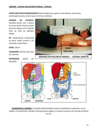 31
ABDOME - LATERAL EM DECÚBITO DORSAL - ESPECIAL
ESTRUTURAS MAIS DEMONSTRADAS: Massas abdominais, gases, níveis líquidos, aneurismas,
calcificação da aorta e outros vasos e hérnias umbilicais.
POSIÇÃO DO PACIENTE:
Decúbito dorsal, com a lateral
do corpo contra o bucky, braços
acima da cabeça, com o topo do
filme ao nível do apêndice
xifóide.
RC: Perpendicular direcionado
ao plano médio coronal 5 cm
acima das cristas ilíacas.
DFOFI: 100 cm
COLIMAÇÃO: Colimar toda área
de interesse.
RESPIRAÇÃO: Apnéia em
expiração.
QUADRANTES E REGIÕES: A cavidade abdominopélvica pode ser dividida em quadrantes ou em
regiões. Em quadrantes a divisão e feita pelo plano sagital e um plano transverso ao nível das vértebras
L3 e L4.
 
