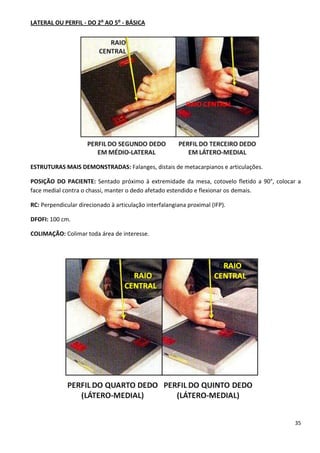 35
LATERAL OU PERFIL - DO 2⁰ AO 5⁰ - BÁSICA
ESTRUTURAS MAIS DEMONSTRADAS: Falanges, distais de metacarpianos e articulações.
POSIÇÃO DO PACIENTE: Sentado próximo à extremidade da mesa, cotovelo fletido a 90°, colocar a
face medial contra o chassi, manter o dedo afetado estendido e flexionar os demais.
RC: Perpendicular direcionado à articulação interfalangiana proximal (IFP).
DFOFI: 100 cm.
COLIMAÇÃO: Colimar toda área de interesse.
 