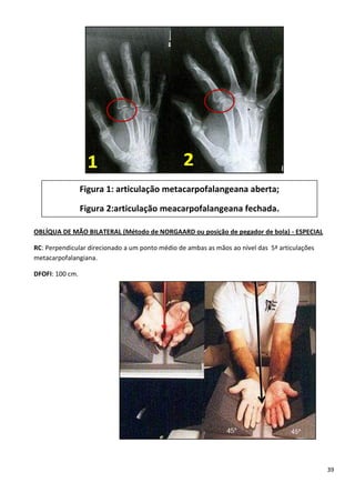39
OBLÍQUA DE MÃO BILATERAL (Método de NORGAARD ou posição de pegador de bola) - ESPECIAL
RC: Perpendicular direcionado a um ponto médio de ambas as mãos ao nível das 5ª articulações
metacarpofalangiana.
DFOFI: 100 cm.
Figura 1: articulação metacarpofalangeana aberta;
Figura 2:articulação meacarpofalangeana fechada.
 