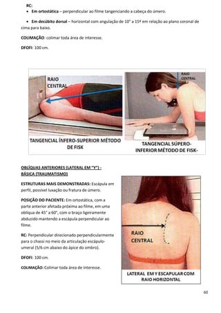 60
RC:
 Em ortostática – perpendicular ao filme tangenciando a cabeça do úmero.
 Em decúbito dorsal – horizontal com angulação de 10° a 15º em relação ao plano coronal de
cima para baixo.
COLIMAÇÃO: colimar toda área de interesse.
DFOFI: 100 cm.
OBLÍQUAS ANTERIORES (LATERAL EM “Y”) -
BÁSICA (TRAUMATISMO)
ESTRUTURAS MAIS DEMONSTRADAS: Escápula em
perfil, possível luxação ou fratura de úmero.
POSIÇÃO DO PACIENTE: Em ortostática, com a
parte anterior afetada próxima ao filme, em uma
oblíqua de 45° a 60°, com o braço ligeiramente
abduzido mantendo a escápula perpendicular ao
filme.
RC: Perpendicular direcionado perpendicularmente
para o chassi no meio da articulação escápulo-
umeral (5/6 cm abaixo do ápice do ombro).
DFOFI: 100 cm.
COLIMAÇÃO: Colimar toda área de interesse.
 