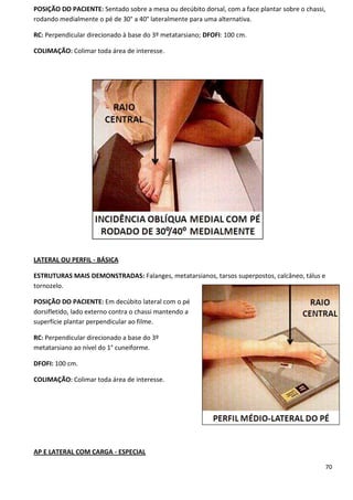 70
POSIÇÃO DO PACIENTE: Sentado sobre a mesa ou decúbito dorsal, com a face plantar sobre o chassi,
rodando medialmente o pé de 30° a 40° lateralmente para uma alternativa.
RC: Perpendicular direcionado à base do 3º metatarsiano; DFOFI: 100 cm.
COLIMAÇÃO: Colimar toda área de interesse.
LATERAL OU PERFIL - BÁSICA
ESTRUTURAS MAIS DEMONSTRADAS: Falanges, metatarsianos, tarsos superpostos, calcâneo, tálus e
tornozelo.
POSIÇÃO DO PACIENTE: Em decúbito lateral com o pé
dorsifletido, lado externo contra o chassi mantendo a
superfície plantar perpendicular ao filme.
RC: Perpendicular direcionado a base do 3º
metatarsiano ao nível do 1° cuneiforme.
DFOFI: 100 cm.
COLIMAÇÃO: Colimar toda área de interesse.
AP E LATERAL COM CARGA - ESPECIAL
 