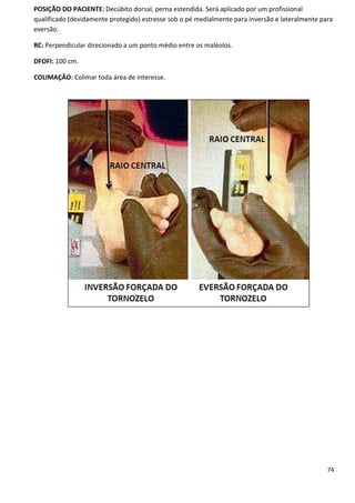 74
POSIÇÃO DO PACIENTE: Decúbito dorsal, perna estendida. Será aplicado por um profissional
qualificado (devidamente protegido) estresse sob o pé medialmente para inversão e lateralmente para
eversão.
RC: Perpendicular direcionado a um ponto médio entre os maléolos.
DFOFI: 100 cm.
COLIMAÇÃO: Colimar toda área de interesse.
 
