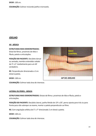 77
DFOFI: 100 cm.
COLIMAÇÃO: Colimar incluindo joelho e tornozelo.
JOELHO
AP - BÁSICA
ESTRUTURAS MAIS DEMONSTRADAS:
Distal de fêmur, proximais de tíbia e
fíbula, patela e articulações.
POSIÇÃO DO PACIENTE: Decúbito dorsal
ou sentado, membro estendido rodado
de 3° a 5° medialmente para um AP
verdadeiro.
RC: Perpendicular direcionado a 2 cm
distal à patela.
DFOFI: 100 cm.
COLIMAÇÃO: Colimar toda área de interesse.
LATERAL OU PERFIL - BÁSICA
ESTRUTURAS MAIS DEMONSTRADAS: Distais de fêmur, proximais de tíbia e fíbula, patela e
articulações.
POSIÇÃO DO PACIENTE: Decúbito lateral, joelho fletido de 15º a 20°, perna oposta para trás ou para
frente para não sobrepor ao exame, manter a patela perpendicular ao filme.
RC: Com angulação cefálica de 5° a 7° direcionado 2 cm distal a patela.
DFOFI: 100 cm.
COLIMAÇÃO: Colimar toda área de interesse.
 