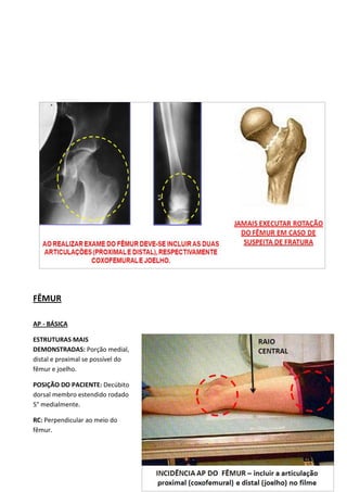 85
FÊMUR
AP - BÁSICA
ESTRUTURAS MAIS
DEMONSTRADAS: Porção medial,
distal e proximal se possível do
fêmur e joelho.
POSIÇÃO DO PACIENTE: Decúbito
dorsal membro estendido rodado
5° medialmente.
RC: Perpendicular ao meio do
fêmur.
 