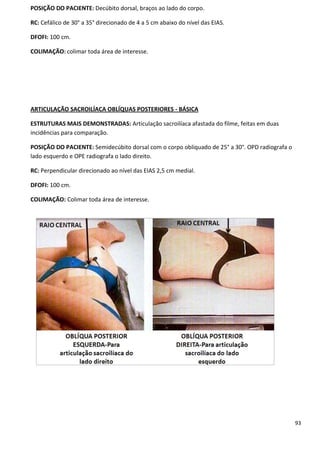 93
POSIÇÃO DO PACIENTE: Decúbito dorsal, braços ao lado do corpo.
RC: Cefálico de 30° a 35° direcionado de 4 a 5 cm abaixo do nível das EIAS.
DFOFI: 100 cm.
COLIMAÇÃO: colimar toda área de interesse.
ARTICULAÇÃO SACROILÍACA OBLÍQUAS POSTERIORES - BÁSICA
ESTRUTURAS MAIS DEMONSTRADAS: Articulação sacroilíaca afastada do filme, feitas em duas
incidências para comparação.
POSIÇÃO DO PACIENTE: Semidecúbito dorsal com o corpo obliquado de 25° a 30°. OPD radiografa o
lado esquerdo e OPE radiografa o lado direito.
RC: Perpendicular direcionado ao nível das EIAS 2,5 cm medial.
DFOFI: 100 cm.
COLIMAÇÃO: Colimar toda área de interesse.
 