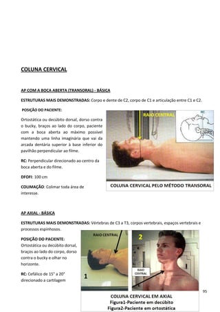 95
COLUNA CERVICAL
AP COM A BOCA ABERTA (TRANSORAL) - BÁSICA
ESTRUTURAS MAIS DEMONSTRADAS: Corpo e dente de C2, corpo de C1 e articulação entre C1 e C2.
POSIÇÃO DO PACIENTE:
Ortostática ou decúbito dorsal, dorso contra
o bucky, braços ao lado do corpo, paciente
com a boca aberta ao máximo possível
mantendo uma linha imaginária que vai da
arcada dentária superior à base inferior do
pavilhão perpendicular ao filme.
RC: Perpendicular direcionado ao centro da
boca aberta e do filme.
DFOFI: 100 cm
COLIMAÇÃO: Colimar toda área de
interesse.
AP AXIAL - BÁSICA
ESTRUTURAS MAIS DEMONSTRADAS: Vértebras de C3 a T3, corpos vertebrais, espaços vertebrais e
processos espinhosos.
POSIÇÃO DO PACIENTE:
Ortostática ou decúbito dorsal,
braços ao lado do corpo, dorso
contra o bucky e olhar no
horizonte.
RC: Cefálico de 15° a 20°
direcionado a cartilagem
 