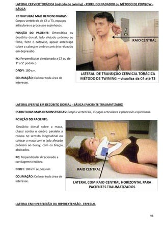 98
LATERAL CERVICOTORÁCICA (método de twining) - PERFIL DO NADADOR ou MÉTODO DE POWLOW -
BÁSICA
ESTRUTURAS MAIS DEMONSTRADAS:
Corpos vertebrais de C4 a T3, espaços
articulares e processos espinhosos.
POSIÇÃO DO PACIENTE: Ortostática ou
decúbito dorsal, lado afetado próximo ao
filme, fletir o cotovelo, apoiar antebraço
sobre a cabeça e ombro contrário relaxado
em depressão.
RC: Perpendicular direcionado a C7 ou de
3° a 5° podálico.
DFOFI: 180 cm.
COLIMAÇÃO: Colimar toda área de
interesse.
LATERAL (PERFIL) EM DECÚBITO DORSAL - BÁSICA (PACIENTE TRAUMATIZADO)
ESTRUTURAS MAIS DEMONSTRADAS: Corpos vertebrais, espaços articulares e processos espinhosos.
POSIÇÃO DO PACIENTE:
Decúbito dorsal sobre a maca,
chassi contra o ombro paralelo a
coluna no sentido longitudinal ou
colocar a maca com o lado afetado
próximo ao bucky, com os braços
abaixados.
RC: Perpendicular direcionado a
cartilagem tireóidea.
DFOFI: 180 cm se possível.
COLIMAÇÃO: Colimar toda área de
interesse.
LATERAL EM HIPERFLEXÃO OU HIPEREXTENSÃO - ESPECIAL
 