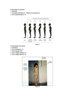 8) Articulação do cotovelo:
( ) Alinhada;
( ) Aumento da flexão D / E Ângulo de carregamento:
( ) Com hiperextensão D / E.
Figura 7
9) Articulações dos ombros:
( ) Alinhados;
( ) Com protração D / E;
( ) Com retração D /E;
( ) Com rotação medial D / E;
( ) Com rotação lateral D / E.
Figura 8
 