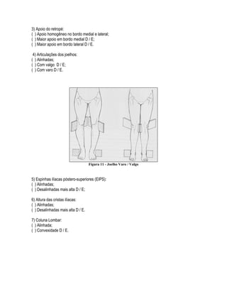 3) Apoio do retropé:
( ) Apoio homogêneo no bordo medial e lateral;
( ) Maior apoio em bordo medial D / E;
( ) Maior apoio em bordo lateral D / E.
4) Articulações dos joelhos:
( ) Alinhadas;
( ) Com valgo D / E;
( ) Com varo D / E.
Figura 11 - Joelho Varo / Valgo
5) Espinhas ilíacas póstero-superiores (EIPS):
( ) Alinhadas;
( ) Desalinhadas mais alta D / E;
6) Altura das cristas ilíacas:
( ) Alinhadas;
( ) Desalinhadas mais alta D / E.
7) Coluna Lombar:
( ) Alinhada;
( ) Convexidade D / E.
 