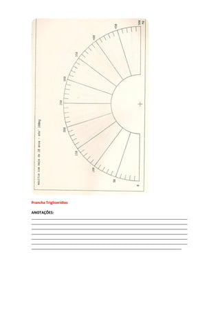 Prancha Trigliceridios
ANOTAÇÕES:
_____________________________________________________________________________
_____________________________________________________________________________
_____________________________________________________________________________
_____________________________________________________________________________
_____________________________________________________________________________
_____________________________________________________________________________
__________________________________________________________________________
 