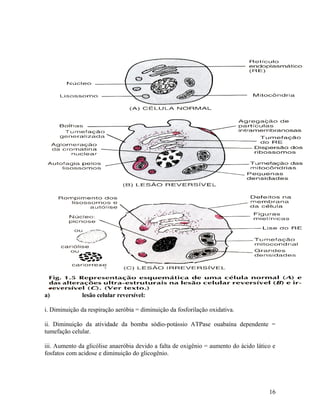 a) lesão celular reversível:
i. Diminuição da respiração aeróbia = diminuição da fosforilação oxidativa.
ii. Diminuição da atividade da bomba sódio-potássio ATPase ouabaína dependente =
tumefação celular.
iii. Aumento da glicólise anaeróbia devido a falta de oxigênio = aumento do ácido lático e
fosfatos com acidose e diminuição do glicogênio.
16
 