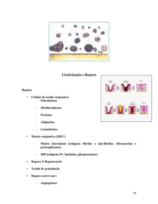 Cicatrização e Reparo
Reparo
• Células do tecido conjuntivo
– Fibroblastos
– Miofibroblastos
– Pericitos
– Adipócitos
– Leiomiócitos
• Matriz conjuntiva (MEC)
– Matriz intersticial (colágeno fibrilar e não-fibrilar, fibronectina e
proteoglicanos)
– MB (colágeno IV, laminina, glicoproteínas)
• Reparo X Regeneração
• Tecido de granulação
• Reparo ocorre por:
– Angiogênese
30
 