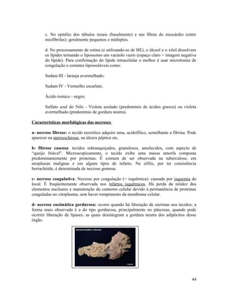 c. No epitélio dos túbulos renais (basalmente) e nas fibras do miocárdio (entre
miofibrilas): geralmente pequenos e múltiplos.
d. No processamento de rotina (e utilizando-se de HE), o álcool e o xilol dissolvem
os lípides tornando o lipossomo um vacúolo vazio (espaço claro = imagem negativa
do lípide). Para confirmação do lípide intracelular o melhor é usar microtomia de
congelação e corantes lipossolúveis como:
Sudam III - laranja avermelhado;
Sudam IV - Vermelho escarlate;
Ácido ósmico - negro;
Sulfato azul do Nilo - Violeta azulado (predomínio de ácidos graxos) ou violeta
avermelhado (predomínio de gordura neutra).
Características morfológicas das necroses
a- necrose fibrose: o tecido necrótico adquire uma, acidofílico, semelhante a fibrina. Pode
aparecer na ateroesclerose, na úlcera péptica etc.
b- fibrose caseosa: tecidos esbranquiçados, granulosos, amolecidos, com aspecto de
“queijo friável". Microscopicamente, o tecido exibe uma massa amorfa composta
predominantemente por proteínas. É comum de ser observada na tuberculose, em
neoplasias malignas e em alguns tipos de infarto. Na sífilis, por ter consistência
borrachóide, é denominada de necrose gomosa.
c- necrose coagulativa: Necrose por coagulação (= isquêmica): causada por isquemia do
local. É freqüentemente observada nos infartos isquêmicos. Há perda da nitidez dos
elementos nucleares e manutenção do contorno celular devido à permanência de proteínas
coaguladas no citoplasma, sem haver rompimento da membrana celular.
d- necrose enzimática gordurosa: ocorre quando há liberação de enzimas nos tecidos; a
forma mais observada é a do tipo gordurosa, principalmente no pâncreas, quando pode
ocorrer liberação de lipases, as quais desintegram a gordura neutra dos adipócitos desse
órgão.
44
 