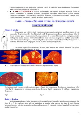 como tratamento principal (leucemias, linfomas, câncer de testículo), mas normalmente é adjuvante,
após tratamento cirúrgico ou radioterápico.
• • 4. TERAPIA BIOLÓGICA. Usa-se modificadores da resposta biológica do corpo frente ao
câncer, "ajudando-o" a combater a doença (linfoquinas, anticorpos monoclonais). Usa-se também
drogas que melhoram a diferenciação das células tumorais, tornando-as de mais fácil controle. Este
tipo de tratamento, em estudo, é o mais promissor para o futuro.
PARTE 2 – INFORMAÇÕES SOBRE OS TIPOS DE CÂNCER MAIS COMUM
CÂNCER DE FÍGADO
Sinais de alerta
Geralmente não existem sinais e sintomas, precocemente, ocorrendo quando a doença já está
avançada. Os principais são: dor abdominal, perda de peso, diminuição do apetite, náusea, além de
febre, icterícia (pele e mucosas amareladas), aumento do volume abdominal, mal-estar generalizado,
inchaço nas pernas e massa palpável no abdome. Esses sintomas em geral são também relacionados
com outras doenças benignas. O câncer de fígado só passa a ser considerado como hipótese quando os
sintomas demoram muito tempo para passar, ou então pioram abruptamente.
O carcinoma hepatocelular representa a quase total maioria dos tumores primários do fígado,
sendo responsável pela ocorrência de 80%.
  Nas crianças, o tumor primário mais comum é o hepatoblastoma (figs.)
Os tipos que mais comumente dão metástase para o fígado são: o carcinoma do pâncreas, o carcinoma colo-
retal (fig.1), o carcinoma de estômago, o carcinoma da mama (fig.2), o carcinoma do esôfago e o carcinoma
do pulmão.
fig.1 fig.2
Fatores de risco
Muitos casos estão associados com a cirrose hepática e hepatite causadas por vírus, principalmente dos
tipo B e C. Os pacientes com cirrose secundária a hepatite viral devem ser alvo de um rigoroso
acompanhamento, pois têm uma maior predisposição ao tumor. A vacinação contra a hepatite B tem, portanto,
caráter preventivo.
4
 