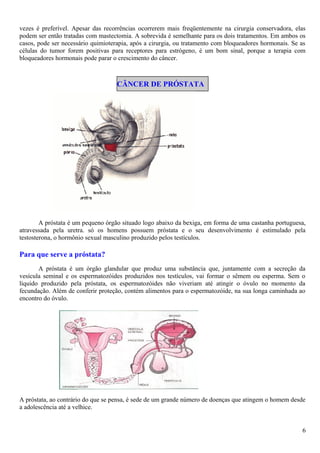 vezes é preferível. Apesar das recorrências ocorrerem mais freqüentemente na cirurgia conservadora, elas
podem ser então tratadas com mastectomia. A sobrevida é semelhante para os dois tratamentos. Em ambos os
casos, pode ser necessário quimioterapia, após a cirurgia, ou tratamento com bloqueadores hormonais. Se as
células do tumor forem positivas para receptores para estrógeno, é um bom sinal, porque a terapia com
bloqueadores hormonais pode parar o crescimento do câncer.
CÂNCER DE PRÓSTATA
A próstata é um pequeno órgão situado logo abaixo da bexiga, em forma de uma castanha portuguesa,
atravessada pela uretra. só os homens possuem próstata e o seu desenvolvimento é estimulado pela
testosterona, o hormônio sexual masculino produzido pelos testículos.
Para que serve a próstata?
A próstata é um órgão glandular que produz uma substância que, juntamente com a secreção da
vesícula seminal e os espermatozóides produzidos nos testículos, vai formar o sêmem ou esperma. Sem o
líquido produzido pela próstata, os espermatozóides não viveriam até atingir o óvulo no momento da
fecundação. Além de conferir proteção, contém alimentos para o espermatozóide, na sua longa caminhada ao
encontro do óvulo.
A próstata, ao contrário do que se pensa, é sede de um grande número de doenças que atingem o homem desde
a adolescência até a velhice.
6
 