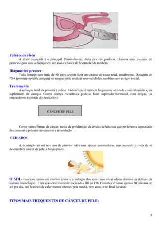 Fatores de risco
A idade avançada é o principal. Possivelmente, dieta rica em gorduras. Homens com parentes de
primeiro grau com a doença têm um maior chance de desenvolvê-la também.
Diagnóstico precoce
Todo homem com mais de 50 anos deveria fazer um exame de toque retal, anualmente. Dosagem de
PSA (prostate-specific antigen) no sangue pode sinalizar anormalidades, também num estágio inicial.
Tratamento
A remoção total da próstata é rotina. Radioterapia é também largamente utilizada como alternativa, ou
suplemento da cirurgia. Contra doença metastática, pode-se fazer supressão hormonal, com drogas, ou
orquiectomia (retirada dos testículos).
Como outras formas de câncer, nasce da proliferação de células defeituosas que perderam a capacidade
de controlar o próprio crescimento e reprodução.
CUIDADOS
A exposição ao sol sem uso de protetor não causa apenas queimaduras, mas aumenta o risco de se
desenvolver câncer de pele, a longo prazo.
O SOL- Funciona como um enorme reator e a radiação dos seus raios ultravioletas diminui as defesas do
sistema imunológico. Tem ação extremamente nociva das 10h às 15h. O melhor é tomar apenas 20 minutos de
sol por dia, nos horários de calor menos intenso: pela manhã, bem cedo, e no final da tarde.
TIPOS MAIS FREQUENTES DE CÂNCER DE PELE:
8
CÂNCER DE PELE
 