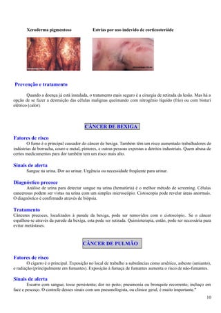 Xeroderma pigmentoso Estrias por uso indevido de corticosteróide
Prevenção e tratamento
Quando a doença já está instalada, o tratamento mais seguro é a cirurgia de retirada da lesão. Mas há a
opção de se fazer a destruição das células malignas queimando com nitrogênio líquido (frio) ou com bisturi
elétrico (calor).
CÂNCER DE BEXIGA
Fatores de risco
O fumo é o principal causador do câncer de bexiga. Também têm um risco aumentado trabalhadores de
indústrias de borracha, couro e metal, pintores, e outras pessoas expostas a detritos industriais. Quem abusa de
certos medicamentos para dor também tem um risco mais alto.
Sinais de alerta
Sangue na urina. Dor ao urinar. Urgência ou necessidade freqüente para urinar.
Diagnóstico precoce
Análise de urina para detectar sangue na urina (hematúria) é o melhor método de screening. Células
cancerosas podem ser vistas na urina com um simples microscópio. Cistoscopia pode revelar áreas anormais.
O diagnóstico é confirmado através de biópsia.
Tratamento
Cânceres precoces, localizados à parede da bexiga, pode ser removidos com o cistoscópio.. Se o câncer
espalhou-se através da parede da bexiga, esta pode ser retirada. Quimioterapia, então, pode ser necessária para
evitar metástases.
CÂNCER DE PULMÃO
Fatores de risco
O cigarro é o principal. Exposição no local de trabalho a substâncias como arsênico, asbesto (amianto),
e radiação (principalmente em fumantes). Exposição à fumaça de fumantes aumenta o risco de não-fumantes.
Sinais de alerta
Escarro com sangue; tosse persistente; dor no peito; pneumonia ou bronquite recorrente; inchaço em
face e pescoço. O controle desses sinais com um pneumologista, ou clínico geral, é muito importante."
10
 