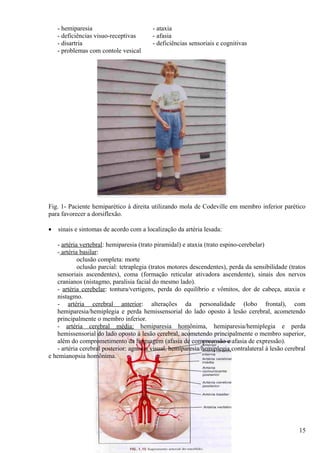 - hemiparesia - ataxia
- deficiências visuo-receptivas - afasia
- disartria - deficiências sensoriais e cognitivas
- problemas com contole vesical
Fig. 1- Paciente hemiparético à direita utilizando mola de Codeville em membro inferior parético
para favorecer a dorsiflexão.
• sinais e sintomas de acordo com a localização da artéria lesada:
- artéria vertebral: hemiparesia (trato piramidal) e ataxia (trato espino-cerebelar)
- artéria basilar:
oclusão completa: morte
oclusão parcial: tetraplegia (tratos motores descendentes), perda da sensibilidade (tratos
sensoriais ascendentes), coma (formação reticular ativadora ascendente), sinais dos nervos
cranianos (nistagmo, paralisia facial do mesmo lado).
- artéria cerebelar: tontura/vertigens, perda do equilíbrio e vômitos, dor de cabeça, ataxia e
nistagmo.
- artéria cerebral anterior: alterações da personalidade (lobo frontal), com
hemiparesia/hemiplegia e perda hemissensorial do lado oposto à lesão cerebral, acometendo
principalmente o membro inferior.
- artéria cerebral média: hemiparesia homônima, hemiparesia/hemiplegia e perda
hemissensorial do lado oposto à lesão cerebral, acometendo principalmente o membro superior,
além do comprometimento da linguagem (afasia de compreensão e afasia de expressão).
- artéria cerebral posterior: agnosia visual, hemiparesia/hemiplegia contralateral à lesão cerebral
e hemianopsia homônima.
15
 