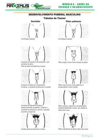 M Ó D U L O 3 - S A Ú D E D A
C R I A N Ç A E D O A D O L E S C E N T E
76 | P á g i n a
 