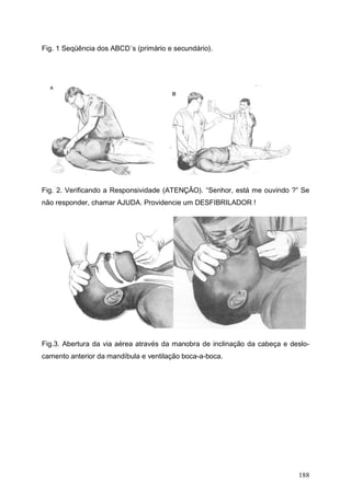 188
Fig. 1 Seqüência dos ABCD´s (primário e secundário).
Fig. 2. Verificando a Responsividade (ATENÇÃO). “Senhor, está me ouvindo ?” Se
não responder, chamar AJUDA. Providencie um DESFIBRILADOR !
Fig.3. Abertura da via aérea através da manobra de inclinação da cabeça e deslo-
camento anterior da mandíbula e ventilação boca-a-boca.
 