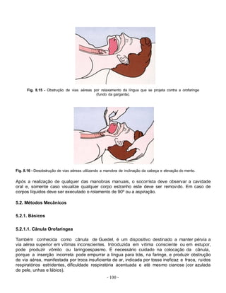 Fig. 8.15 - Obstrução de vias aéreas por relaxamento da língua que se projeta contra a orofaringe
                                            (fundo da garganta).




Fig. 8.16 - Desobstrução de vias aéreas utilizando a manobra de inclinação da cabeça e elevação do mento.

Após a realização de qualquer das manobras manuais, o socorrista deve observar a cavidade
oral e, somente caso visualize qualquer corpo estranho este deve ser removido. Em caso de
corpos líquidos deve ser executado o rolamento de 90º ou a aspiração.

5.2. Métodos Mecânicos

5.2.1. Básicos

5.2.1.1. Cânula Orofaríngea

Também conhecida como cânula de Guedel, é um dispositivo destinado a manter pérvia a
via aérea superior em vítimas inconscientes. Introduzida em vítima consciente ou em estupor,
pode produzir vômito ou laringoespasmo. É necessário cuidado na colocação da cânula,
porque a inserção incorreta pode empurrar a língua para trás, na faringe, e produzir obstrução
de via aérea, manifestada por troca insuficiente de ar, indicada por tosse ineficaz e fraca, ruídos
respiratórios estridentes, dificuldade respiratória acentuada e até mesmo cianose (cor azulada
de pele, unhas e lábios).
                                                     - 100 -
 