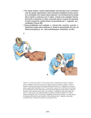 • Por essas razões, muitos especialistas recomendam que 2 profissio-
  nais de saúde experientes e bem treinados trabalhem juntos duran-
  te a ventilação com bolsa-valva-máscara. Um profissional de saúde
  deve manter a máscara com 2 mãos, criando uma vedação hermé-
  tica entre a máscara e a face, enquanto eleva o queixo do paciente.
  O outro comprime a bolsa lenta e suavemente por 1 segundo por
  ventilação (Figura 4B).
• Esses problemas com vedação e volume não ocorrem quando o
  dispositivo bolsa-valva-máscara é fixado à extremidade de uma via
  aérea avançada (p. ex., tubo endotraqueal, combitubo, ou ML).

A




Figura 4. A, Técnica do clamp E–C boca-a-máscara para a manutenção da máscara, enquanto
eleva a mandíbula. Posicione-se próximo da cabeça do paciente. Circule o polegar e o dedo in-
dicador ao redor da parte superior da máscara (formando uma letra “C”) enquanto usa o terceiro,
quarto e quinto dedos (formando a letra “E”) para elevar o queixo. B, Uso de bolsa-valva-máscara
por 2 profissionais de saúde. Aquele que estiver próximo da cabeça da vitima inclina a cabeça do
paciente e veda a máscara contra a face, com o polegar e o indicador de cada mão criando uma
letra “C”, para fornecer uma vedação hermética ao redor dos bordos da máscara. Os 3 dedos
restantes (formando a letra “E”) levantam a mandíbula da vítima (isso mantém a via aérea aberta).
O segundo profissional de saúde comprime a bolsa lentamente (por 1 segundo), até que haja
elevação do tórax. Ambos devem observar a elevação do tórax.




                                        - 108 -
 