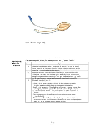 Figura 7. Máscara laríngea (ML).




              Os passos para inserção às cegas da ML (Figura 8) são:
Inserção da
Máscara        Passo                                                      Ação
Laríngea          1     Preparo do equipamento: Checar a integridade da máscara e do tubo, de acordo
                        com as instruções do fabricante. Lubrificar somente a superfície posterior do cuff,
                        para evitar o bloqueio da abertura da via aérea.
                  2     Preparo do paciente: Fornecer oxigenação e ventilação, sedar quando indicado
                        e posicionar o paciente. Note que o uso da ML apresenta risco de regurgitação e
                        aspiração em pacientes não responsivos. Você deve ponderar os riscos e os benefí-
                        cios do estabelecimento de uma via aérea, usando este dispositivo específico.
                  3     Técnica de inserção (Figura 8):

                        • Coloque a ML na faringe e introduza-a às cegas, até sentir resistência. A resistên-
                           cia indica que a extremidade distal do tubo alcançou a hipofaringe.
                        • Insufle o cuff da máscara. A insuflação do cuff empurra a máscara contra a aber-
                           tura traqueal, permitindo que o ar flua através do tubo em direção à traquéia.
                        • A ventilação através do tubo é feita para a abertura no centro da máscara e a
                           traquéia.
                        • Para evitar traumatismos, não use força excessiva em qualquer momento durante
                          a inserção da ML.
                        • Nunca superinsufle o cuff após sua insuflação. A pressão intracuff excessiva
                          pode resultar em mal posicionamento do dispositivo ou causar lesão faringolarín-
                          gea (p. ex., dor de garganta, disfagia ou lesão nervosa).




                                                         - 112 -
 