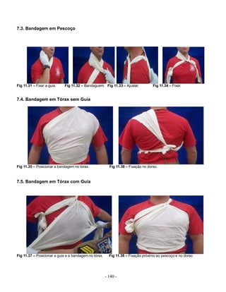 7.3. Bandagem em Pescoço




Fig 11.31 – Fixar a guia.   Fig 11.32 – Bandaguem. Fig 11.33 – Ajustar.            Fig 11.34 – Fixar.


7.4. Bandagem em Tórax sem Guia




Fig 11.35 – Posicionar a bandagem no tórax.              Fig 11.36 – Fixação no dorso.



7.5. Bandagem em Tórax com Guia




Fig 11.37 – Posicionar a guia e a bandagem no tórax.     Fig 11.38 – Fixação próximo ao pescoço e no dorso




                                                       - 140 -
 