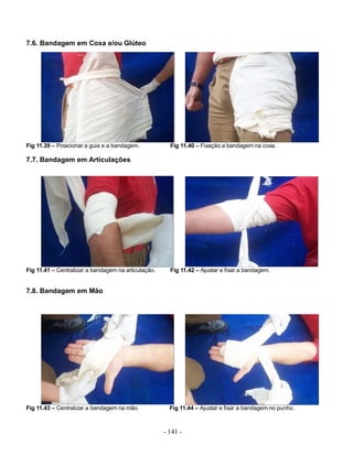 7.6. Bandagem em Coxa e/ou Glúteo




Fig 11.39 – Posicionar a guia e a bandagem.            Fig 11.40 – Fixação a bandagem na coxa.

7.7. Bandagem em Articulações




Fig 11.41 – Centralizar a bandagem na articulação.     Fig 11.42 – Ajustar e fixar a bandagem.


7.8. Bandagem em Mão




Fig 11.43 – Centralizar a bandagem na mão.             Fig 11.44 – Ajustar e fixar a bandagem no punho.



                                                     - 141 -
 