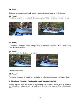 3.4. Passo 3

O posicionamento do socorrista 2 fixando inicialmente a cinta próxima a raíz da coxa

3.5. Passo 4
Fixação da tornozeleira com a cinta de velcro que substituirá a tração na instalação da tala.




Fig 12.13 – Passo 2,3 e 4




3.6. Passo 5

O socorrista 1 somente soltará a tração após o socorrista 2 instalar e fixar a tração pela
catraca do equipamento.

3.7. Passo 6
Fixar as demais fitas da coxa ao tornozelo.




Fig 12.14 – Passo 5,6 e 7.


3.8. Passo 7

Terminar a instalação da tração com avaliação do pulso, sensibilidade e motricidade distal.

4. Fixação da Vitima com Tração de Fêmur na Tábua de Remoção

Quando a vítima foi imobilizada com equipamento de tração portátil de fêmur e necessita
ser colocada em tábua dorsal, o procedimento de rolamento deve ser feito pelo lado sem
lesão.




                                              - 159 -
 