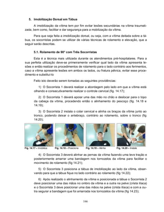 5. Imobilização Dorsal em Tábua

      A imobilização da vítima tem por fim evitar lesões secundárias na vítima traumati-
zada, bem como, facilitar e dar segurança para a mobilização da vítima.

       Para que seja feita a imobilização dorsal, ou seja, com a vítima deitada sobre a tá-
bua, os socorristas podem se utilizar de várias técnicas de rolamento e elevação, que a
seguir serão descritas.

        5.1. Rolamento de 90° com Três Socorristas

      Esta é a técnica mais utilizada durante os atendimentos pré-hospitalares. Para a
sua perfeita utilização deve-se primeiramente verificar qual lado da vítima apresenta le-
sões e então realizar os procedimentos de rolamento para o lado contrário aos ferimentos,
caso a vítima apresente lesões em ambos os lados, ou fratura pélvica, evitar esse proce-
dimento e substituí-lo

        Feito isto deverão serem tomadas as seguintes providências:

            1) O Socorrista 1 deverá realizar a abordagem pelo lado em que a vítima está
         olhando e consecutivamente realizar o controle cervical (fig. 14.17);

            2) O Socorrista 1 deverá apoiar uma das mão no chão e deslocar para o topo
         da cabeça da vítima, procedendo então o alinhamento do pescoço (fig. 14.18 e
         14.19);

            3) O Socorrista 2 instala o colar cervical e alinha os braços da vítima junto ao
         tronco, podendo deixar o antebraço, contrário ao rolamento, sobre o tronco (fig
         14.20);




Fig. 14.17 – Imobiliza   Fig. 14.18 – Posiciona    Fig. 14.19 – Alinha   Fig. 14.20 – Instala

            4) O Socorrista 3 deverá alinhar as pernas da vítima fazendo uma leve tração e
         posteriormente amarrar uma bandagem nos tornozelos da vítima para facilitar o
         movimento de rolamento (fig 14.21);

            5) O Socorrista 3 posiciona a tábua de imobilização ao lado da vítima, obser-
         vando para que a tábua fique no lado contrário ao rolamento (fig 14.22);

             6) Após realizado o alinhamento da vítima e posicionada a tábua o Socorrista 2
         deve posicionar uma das mãos no ombro da vítima e a outra na pelve (crista ilíaca)
         e o Socorrista 3 deve posicionar uma das mãos na pelve (crista ilíaca) e com a ou-
         tra segurar a bandagem que foi amarrada nos tornozelos da vítima (fig 14.23);


                                                  166
 