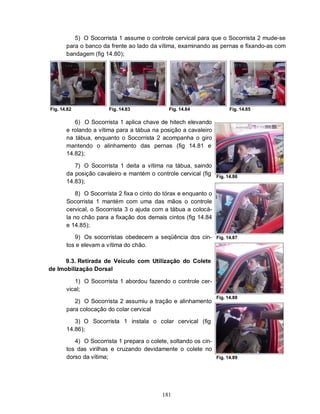 5) O Socorrista 1 assume o controle cervical para que o Socorrista 2 mude-se
       para o banco da frente ao lado da vítima, examinando as pernas e fixando-as com
       bandagem (fig 14.80);




Fig. 14.82             Fig. 14.83             Fig. 14.84                Fig. 14.85

          6) O Socorrista 1 aplica chave de hitech elevando
       e rolando a vítima para a tábua na posição a cavaleiro
       na tábua, enquanto o Socorrista 2 acompanha o giro
       mantendo o alinhamento das pernas (fig 14.81 e
       14.82);

          7) O Socorrista 1 deita a vítima na tábua, saindo
       da posição cavaleiro e mantém o controle cervical (fig     Fig. 14.86
       14.83);

           8) O Socorrista 2 fixa o cinto do tórax e enquanto o
       Socorrista 1 mantém com uma das mãos o controle
       cervical, o Socorrista 3 o ajuda com a tábua a colocá-
       la no chão para a fixação dos demais cintos (fig 14.84
       e 14.85);

          9) Os socorristas obedecem a seqüência dos cin-         Fig. 14.87
       tos e elevam a vítima do chão.

      9.3. Retirada de Veículo com Utilização do Colete
de Imobilização Dorsal

          1) O Socorrista 1 abordou fazendo o controle cer-
       vical;
                                                                  Fig. 14.88
          2) O Socorrista 2 assumiu a tração e alinhamento
       para colocação do colar cervical

          3) O Socorrista 1 instala o colar cervical (fig
       14.86);

          4) O Socorrista 1 prepara o colete, soltando os cin-
       tos das virilhas e cruzando devidamente o colete no
       dorso da vítima;                                           Fig. 14.89




                                           181
 