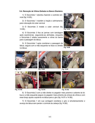 9.4. Remoção de Vítima Deitada no Banco Dianteiro

          1) O Socorrista 1 abordou fazendo o controle cer-
       vical (fig 14.95);

          2) O Socorrista 1 mantém a tração e alinhamento
       para colocação do colar cervical

          3) O Socorrista 2 instala o colar cervical (fig
       14.96);                                                Fig. 14.95

          4) O Socorrista 3 fixa as pernas com bandagem
       após examiná-las, segurando-as alinhadas, enquanto
       o Socorrista 2 afasta suavemente a vítima do banco
       para a passagem da tábua;

          5) O Socorrista 1 após coordenar a passagem da
       tábua, segura com a mão esquerda na face e a direita
                                                              Fig. 14.96
       na tábua;




Fig. 14.97                   Fig. 14.98                   Fig. 14.99




Fig. 14.100                  Fig. 14.101                  Fig. 14.102

          6) O Socorrista 2 com a mão direita no pegador mais próximo e adiante da tá-
       bua e a mão esquerda segura no pegador mais próximo da cintura da vítima e com
       esse braço ajuda a apoiá-la na tábua para o giro (fig 14.97 e 14.98);

          7) O Socorrista 1 em sua contagem coordena o giro e simultaneamente o
       avanço da tábua sem perder o controle da cabeça (fig 14.99);




                                           183
 