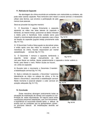 11. Retirada de Capacete

        Na abordagem de vítima envolvida em acidentes com motocicleta ou similares, ela
pode estar usando capacete. Para removê-lo sem mexer a coluna cervical, é necessário
utilizar esta técnica, que envolve a participação de pelo
menos duas pessoas.

Deve-se proceder da seguinte maneira:

1)    O Socorrista 1 segura firmemente o capacete,
apoiando as mãos nas abas laterais do capacete e
tentando, ao mesmo tempo, posicionar os dedos indicador
e médio junto à mandíbula. Este cuidado serve para
impedir a movimentação abrupta do capacete, caso a faixa          Fig. 14.112
de fixação do capacete (jugular) esteja previamente solta
(fig 14.112);

2) O Socorrista 2 solta a faixa jugular se ela estiver presa,
e então apóia uma das mãos no occipital e outra na
mandíbula da vítima, ficando responsável por manter
aestabilização    cervical (fig 14.113);

3) O Socorrista 1 remove o capacete, lembrando o
                                                                Fig. 14.113
seguinte:    tentar    alargar    manualmente     as    late
rais para liberar as orelhas. Apoiar posteriormente o capacete e tentar soltá-lo à
frente, para liberar o nariz. Retirar óculos se houver,
ver, antes do capacete;

4) Durante todo o movimento o Socorrista 2 mantém
a estabilização cervical (fig 14.114);

5) Após a retirada do capacete, o Socorrista 1 posiciona
lateralmente as mãos na cabeça da vítima, a fim de
liberar o Socorrista 2, assumindo a estabilização cervical.
Neste momento é possível adaptar o colar cervical em
posição adequada (fig 14.115).                                  Fig. 14.114




  12. Conclusão

       Estas manobras abrangem praticamente todas as
situações de mobilização de vítimas com suspeita ou con-
firmação de lesão raquimedular. Em alguns casos serão
necessárias pequenas adaptações, que com treinamento
e experiência os socorristas estarão aptos a efetuar de                         Fig. 14.115
acordo com as condições que se apresentarem, porém ,
os princípios básicos     de imobilizações deverão ser
mantidos.


                                            186
 