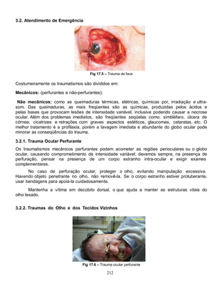 3.2. Atendimento de Emergência




                                      Fig 17.5 – Trauma de face

Costumeiramente os traumatismos são divididos em:

Mecânicos: (perfurantes e não-perfurantes);

 Não mecânicos: como as queimaduras térmicas, elétricas, químicas por, irradiação e ultra-
som. Das queimaduras, as mais freqüentes são as químicas, produzidas pelos ácidos e
pelas bases que provocam lesões de intensidade variável, inclusive podendo causar a necrose
ocular. Além dos problemas imediatos, são freqüentes seqüelas como: simbléfaro, úlcera de
córnea, cicatrizes e retrações com graves aspectos estéticos, glaucomas, cataratas, etc. O
melhor tratamento é a profilaxia, porém a lavagem imediata e abundante do globo ocular pode
minorar as conseqüências do trauma.

3.2.1. Trauma Ocular Perfurante
Os traumatismos mecânicos perfurantes podem acometer as regiões perioculares ou o globo
ocular, causando comprometimento de intensidade variável; devemos sempre, na presença de
perfuração, pensar na presença de um corpo estranho intra-ocular e exigir exames
complementares.
      No caso de perfuração ocular, proteger o olho, evitando manipulação excessiva.
Havendo objeto penetrante no olho, não removê-la. Se o corpo estranho estiver protuberante,
usar bandagens para apoiá-la cuidadosamente.
       Mantenha a vítima em decúbito dorsal, o que ajuda a manter as estruturas vitais do
olho lesado.


3.2.2. Traumas do Olho e dos Tecidos Vizinhos




                                  Fig 17.6 – Trauma ocular perfurante

                                                212
 