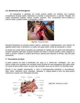 4.2. Atendimento de Emergência

       As lacerações e abrasões do ouvido externo podem ser tratadas com curativos
compressivos de gaze estéril, destinados a controlar o sangramento e a prevenir infecção. Em
orelha seriamente mutilada, aplicar curativo espesso, sem compressão, entre a orelha e o
crânio e sobre a própria orelha, e transportar a vítima.




                                    Fig 17.9 – Trauma de orelha

Havendo ferimentos no conduto auditivo externo, posicionar cuidadosamente uma bolinha de
algodão estéril sobre o ferimento e a orelha com gaze estéril, antes de transportar a vítima.
As lesões do ouvido interno causadas por explosões ou rajadas são em geral muito dolorosas e
sangram bastante. Não fazer qualquer tentativa de limpar o conduto auditivo, retirar coágulos ou
ocluir o conduto. Colocar o curativo bem-frouxo, apenas para absorver os fluidos, mas não para
controlá-los.

5. Traumatismo do Nariz

A parte superior do nariz é constituída por osso e a inferior por cartilagem. Em seu
interior, existe uma cavidade oca (cavidade nasal) dividida em duas passagens pelo septo nasal.
Os ossos da face contêm seios, os quais são cavidades ocas que se abrem na cavidade nasal.

Devido a sua posição proeminente, o nariz é particularmente vulnerável a traumatismos.
Além disso, distúrbios como infecções, epistaxes e pólipos afetam o nariz. Os seios podem
infectar-se e causar uma inflamação (sinusite).




                                                                  Fig 17.10 – Anatomia do ouvido




                                               216
 