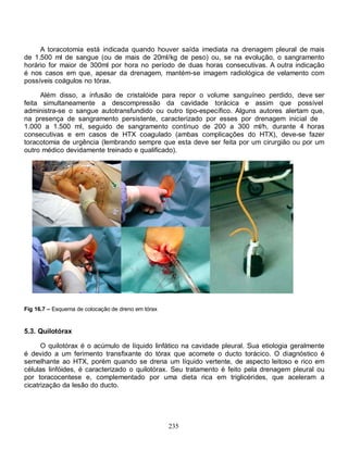 A toracotomia está indicada quando houver saída imediata na drenagem pleural de mais
de 1.500 ml de sangue (ou de mais de 20ml/kg de peso) ou, se na evolução, o sangramento
horário for maior de 300ml por hora no período de duas horas consecutivas. A outra indicação
é nos casos em que, apesar da drenagem, mantém-se imagem radiológica de velamento com
possíveis coágulos no tórax.

      Além disso, a infusão de cristalóide para repor o volume sanguíneo perdido, deve ser
feita simultaneamente a descompressão da cavidade torácica e assim que possível
administra-se o sangue autotransfundido ou outro tipo-específico. Alguns autores alertam que,
na presença de sangramento persistente, caracterizado por esses por drenagem inicial de
1.000 a 1.500 ml, seguido de sangramento contínuo de 200 a 300 ml/h, durante 4 horas
consecutivas e em casos de HTX coagulado (ambas complicações do HTX), deve-se fazer
toracotomia de urgência (lembrando sempre que esta deve ser feita por um cirurgião ou por um
outro médico devidamente treinado e qualificado).




Fig 16.7 – Esquema de colocação de dreno em tórax


5.3. Quilotórax

      O quilotórax é o acúmulo de líquido linfático na cavidade pleural. Sua etiologia geralmente
é devido a um ferimento transfixante do tórax que acomete o ducto torácico. O diagnóstico é
semelhante ao HTX, porém quando se drena um líquido vertente, de aspecto leitoso e rico em
células linfóides, é caracterizado o quilotórax. Seu tratamento é feito pela drenagem pleural ou
por toracocentese e, complementado por uma dieta rica em triglicérides, que aceleram a
cicatrização da lesão do ducto.




                                                    235
 